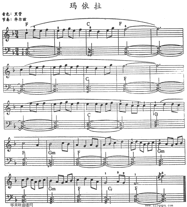 ������(������V)1